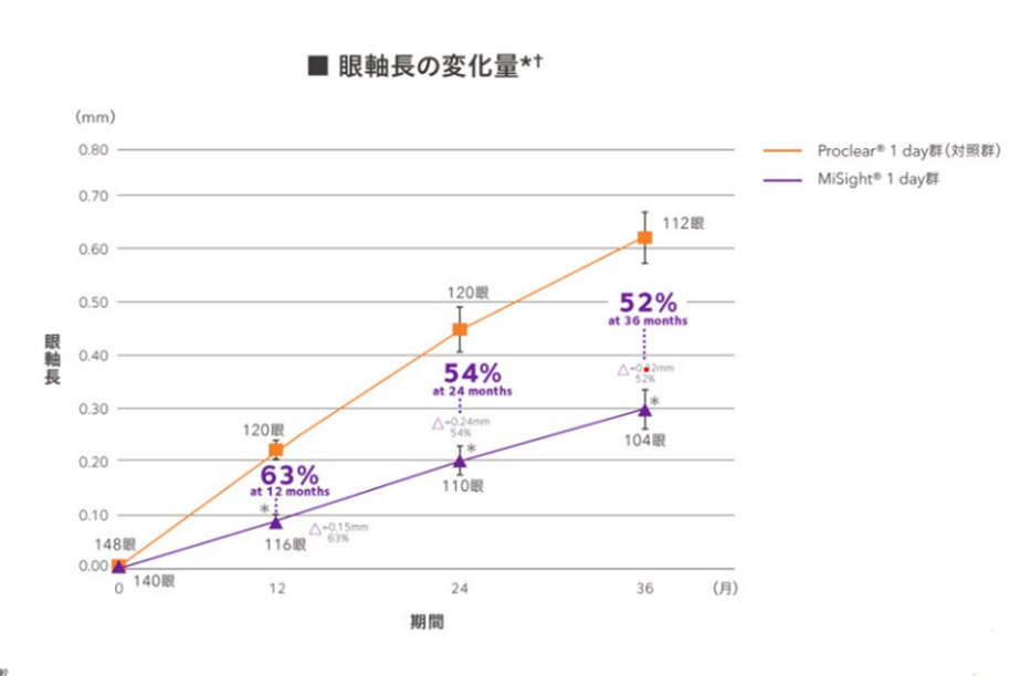 新たな近視矯正法 オルソケラトロジー(自費診療)